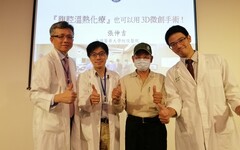 大腸癌腹膜轉移 微創3D手術加腹腔溫熱化療 抗癌更順利