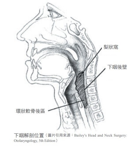 下咽癌 嗓音與吞嚥功能的殺手