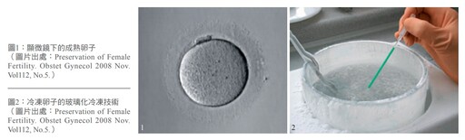 有「 凍」有機會 女性提前為自己保存生育力