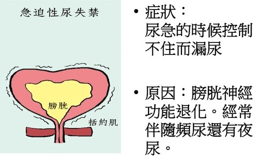 婦女尿失禁的治療