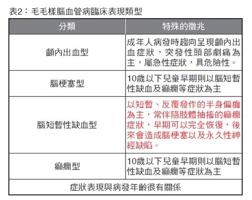 化解腦血管危機 出血性腦中風與毛毛樣腦血管病