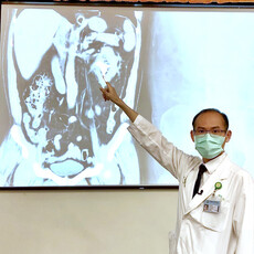 憋尿憋出鹿角狀腎結石 微創雙鏡聯合手術一次清除