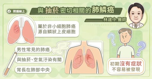 免疫治療接續標靶治療，提升肺鱗癌治療成效、優化生活品質，「醫病共享決策」創雙贏，專科醫師圖文解說