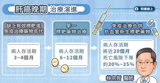 健保給付肝癌晚期一線治療新利器：免疫治療合併抗血管新生標靶 五大關鍵解析