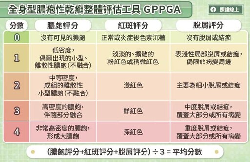 快速緩解疼痛、清除膿疱！新型生物製劑提升全身型膿疱性乾癬治療成效，皮膚專科醫師圖文解說