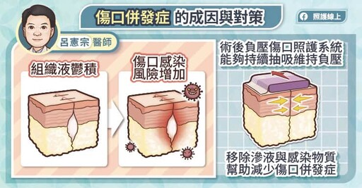 骨折手術要提防感染、骨髓炎，傷口併發症的成因與對策，骨科醫師圖文解析