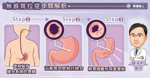 破解減重迷思，健康減重不復胖！胃腸專科醫師圖文解說