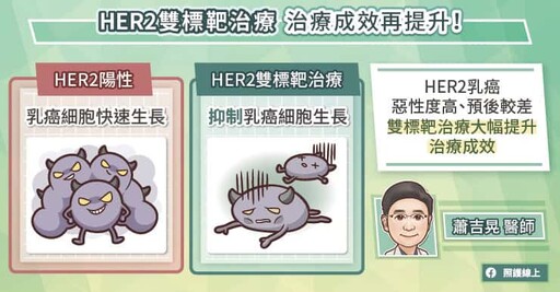 乳癌治療便利性大進化！HER2雙標靶藥物皮下注射新劑型–早期、晚期都受惠，腫瘤專科醫師圖文懶人包