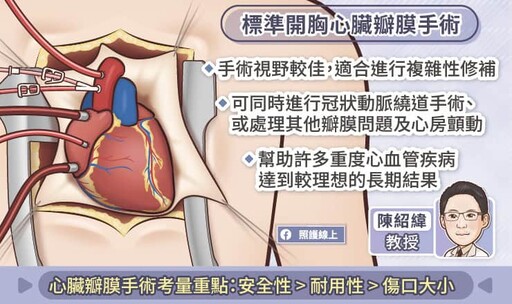 微創心臟瓣膜手術關鍵QA，二尖瓣逆流術前要知道！心臟外科醫師圖文懶人包