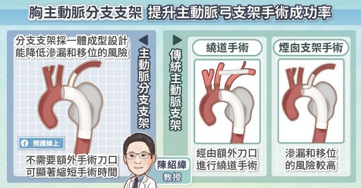 微創主動脈支架手術再進化，血管內固定錨釘納健保給付，主動脈瘤與主動脈剝離混合式手術解析，心臟血管外科醫師圖文懶人包