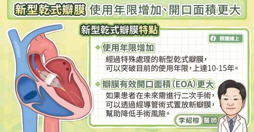 二尖瓣狹窄或逆流都會影響心臟功能，修補、置換人工瓣膜解析，心臟血管外科醫師圖文懶人包