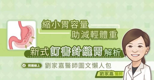 縮小胃容量助減輕體重，新式訂書針縫胃解析，劉家嘉醫師圖文懶人包