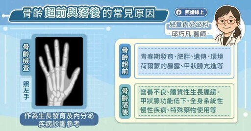 為什麼骨齡會超前?兒童內分泌專科醫師圖文解說