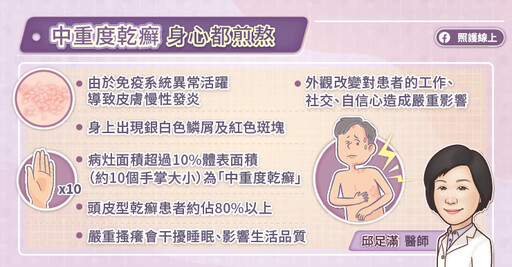 中重度乾癬迎治療新曙光！新型口服小分子標靶藥物（TYK2抑制劑）精準鎖定頭皮型病灶、改善生活品質，緩解搔癢、提升自信──皮膚專科醫師圖文解說