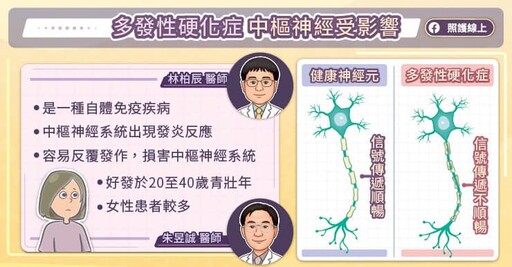 藥少不等於效果差!多元的治療選擇讓多發性硬化症患者 生活不再被病耽誤