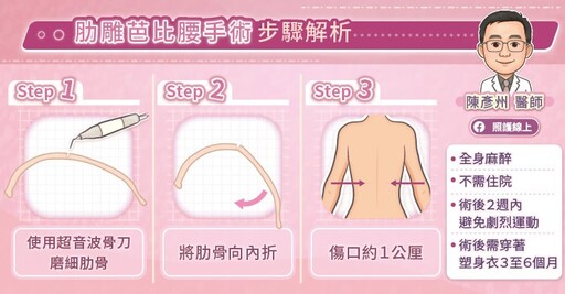 腰部曲線改善對策解析,肋雕芭比腰手術步驟與特點,整形外科陳彥州醫師圖文解說