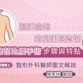 腰部曲線改善對策解析，肋雕芭比腰手術步驟與特點，整形外科陳彥州醫師圖文解說