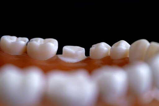 【有影】缺牙不再是問題！補骨粉助力植牙重建自信微笑