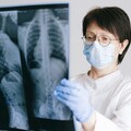 台灣肺癌還有新警訊！ 「一族群」10年增9成、平均少活9.7年