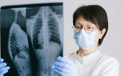 台灣肺癌還有新警訊！ 「一族群」10年增9成、平均少活9.7年