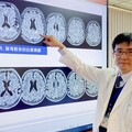 台灣人特有1%基因變異作怪 中榮研究：48歲後就可能腦中風、失智！