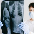 她胸悶、喘不過氣一拖半年 送醫驚見「主動脈瓣膜少一片」險猝死