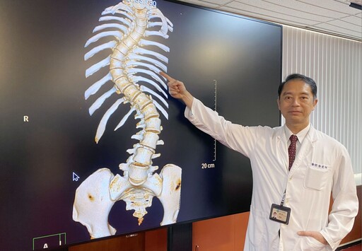 女學生「脊椎變形蜈蚣」呼吸都痛！ 醫妙手截彎取直長高8公分
