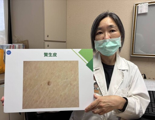 熟女三角地帶「凸一塊」天天磨到劇痛！ 原來贅生皮作怪