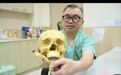 建築工跌落5公尺「臉著地」面目全非！ 醫靠隱形重建拚回臉龐