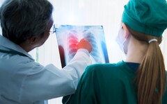 【COPD防治行動3-3】十大死因防治斷層 呼籲將慢性阻塞性肺病納國家計畫