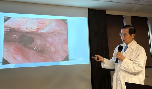 養生魔人「日吞20顆保健品」卻胸悶胸痛 竟吃出食道潰瘍!