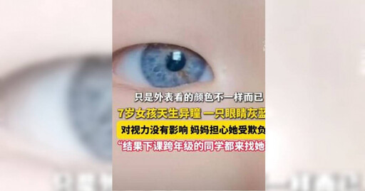 7歲女孩「天生異瞳」一眼黑一眼灰藍 醫生揭原因：1情況快就醫