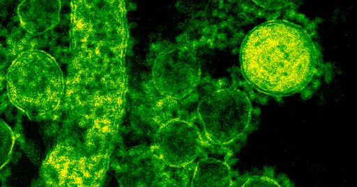 陸傳hMPV致死率恐達43％ 醫揭台灣現況：檢測能力不足