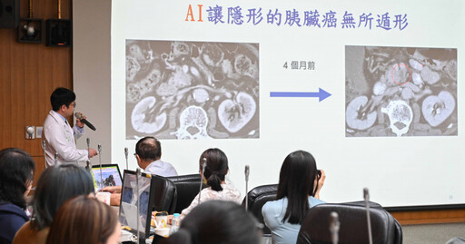 「台大AI助手」好給力 突破瓶頸!2分鐘揪出早期胰臟癌