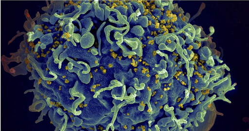 治癒愛滋病有望了?科學家透過mRNA技術找出潛藏HIV病毒