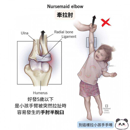 孩子哭鬧別硬拉!兒科醫師警告:小心「牽拉肘」傷害