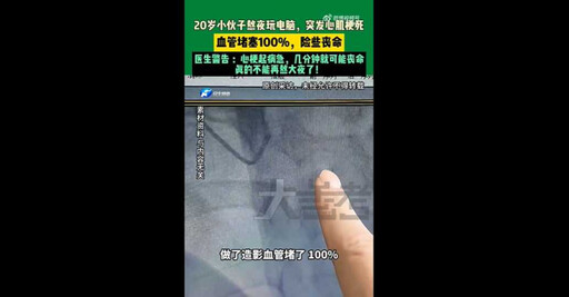 才20歲就心梗!男大生突發急性心肌梗塞 醫揭真相:年輕人不是鐵打的