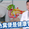 從便色看健康！醫曝5警訊：變這2色恐罹癌