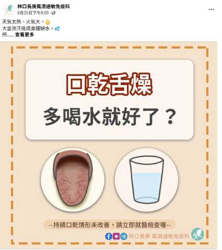 口乾舌燥別只怪天氣熱! 醫提醒:恐是5種潛藏疾病警訊