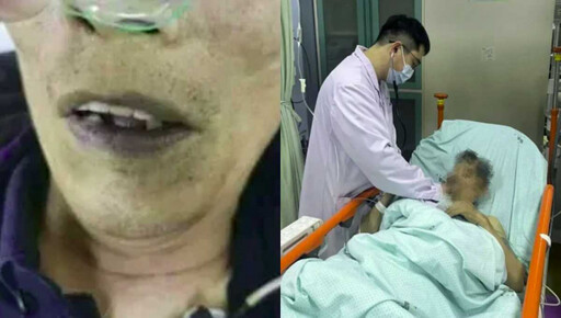 老翁吃自製醃菜暈倒「全身發紫」 醫師檢查發現是亞硝酸鹽中毒