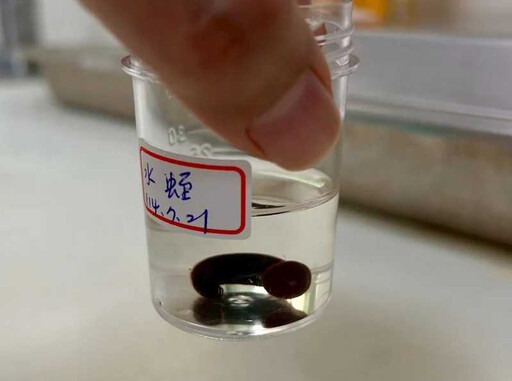 喉嚨有異物「以為感冒卡痰」 南投男就醫從鼻腔夾出4cm水蛭