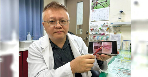 愛犬突抓狂!台中妙齡女逗狗遭狠咬 「嘴邊肉掉一塊」驚悚傷勢曝光