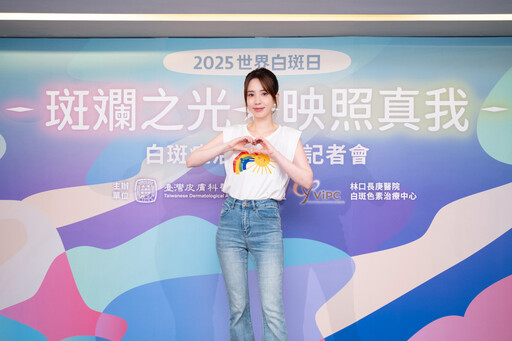 麥可傑克森曾陷白斑症困擾！愛雅任公益大使「曾誤以為會傳染」 醫揭疾病迷思