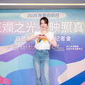 麥可傑克森曾陷白斑症困擾！愛雅任公益大使「曾誤以為會傳染」 醫揭疾病迷思