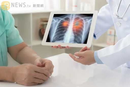 父長期在家吸菸！害11歲兒反覆發燒、咳嗽 就醫驚已罹肺癌