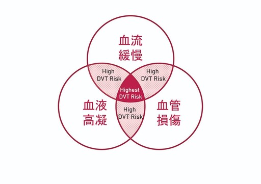 被忽視的靜脈殺手！久坐、飛行易罹患 醫示警：1徵兆恐致命