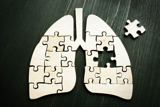 肺癌是台灣人最好發癌症，死亡率也是第一高，透過2方法，幫助患者延長生命