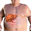 明明很瘦卻有脂肪肝，問題可能出在「2食物」！ 營養師搖頭：很多人以為很養生