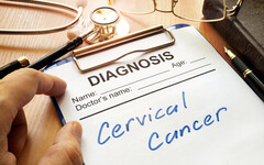20出頭就罹患子宮頸癌！醫示警高風險HPV感染年輕化
