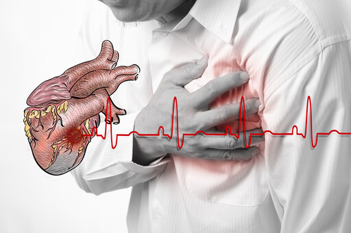 感染新冠導致心肌梗塞險送命，確診後感到胸悶胸痛，絕不能輕忽，務必盡速就醫